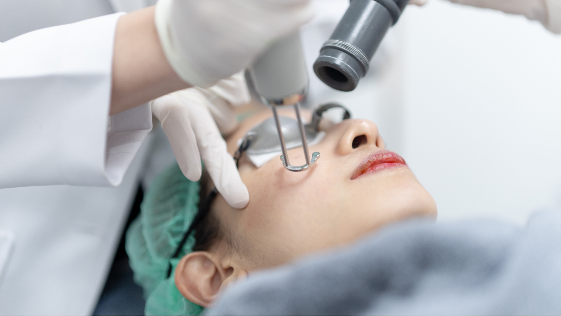 Morpheus8 fractional RF microneedling treatment